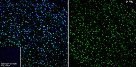 HUABIO HA750240 image 1