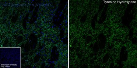 HUABIO HA750243 image 1