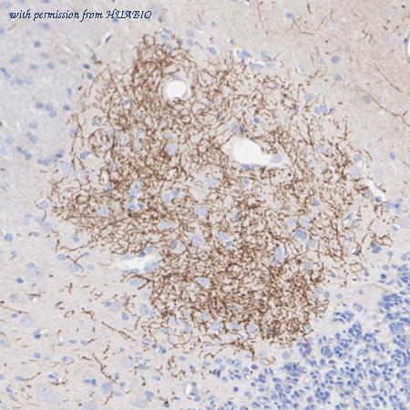 HUABIO HA750243 image 3