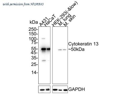 HUABIO HA750261 image 1