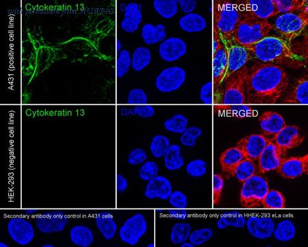HUABIO HA750261 image 2