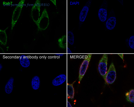 HUABIO HA750279 image 3