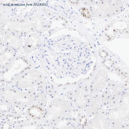 HUABIO HA750306 image 2