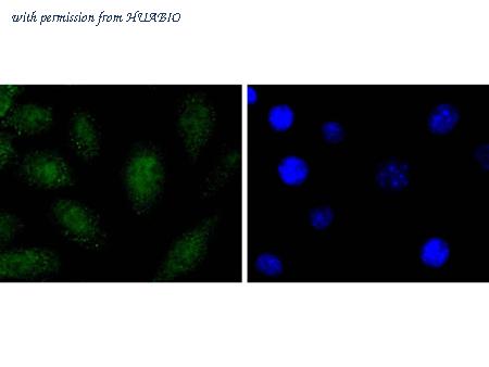 HUABIO HA750308 image 3