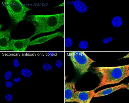 HUABIO HA750320 image 3