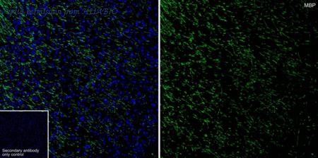 HUABIO HA750337 image 1