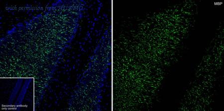 HUABIO HA750337 image 2