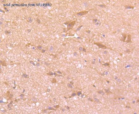 HUABIO HA750338 image 1