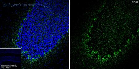 HUABIO HA750357 image 3