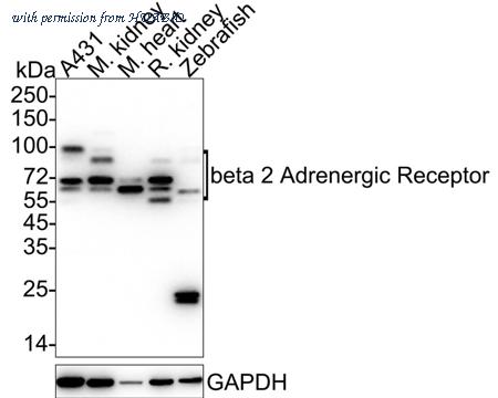 HUABIO HA750368 image 3