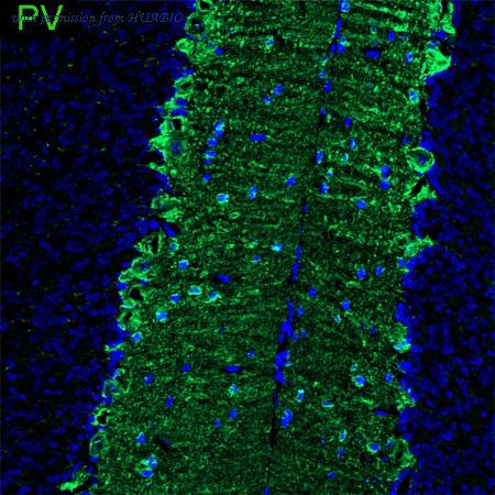 HUABIO HA750371 image 3