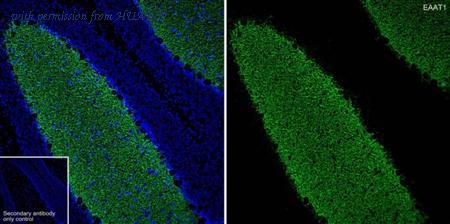 HUABIO HA750415 image 1