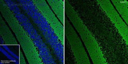 HUABIO HA750415 image 3