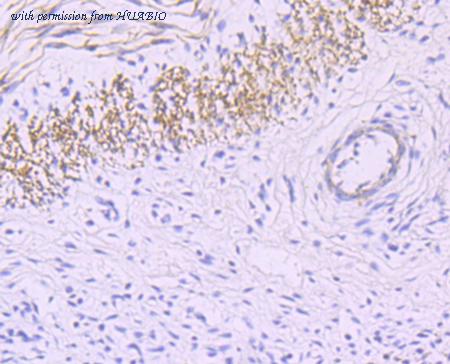 HUABIO HA750417 image 3