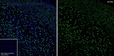 HUABIO HA750449 image 1