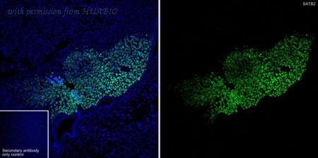 HUABIO HA750449 image 2