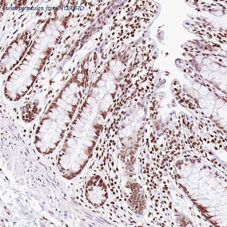 HUABIO HA750464 image 3