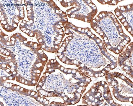 HUABIO HA750477 image 3