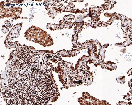 HUABIO HA750554 image 2