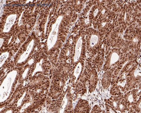 HUABIO HA750586 image 2