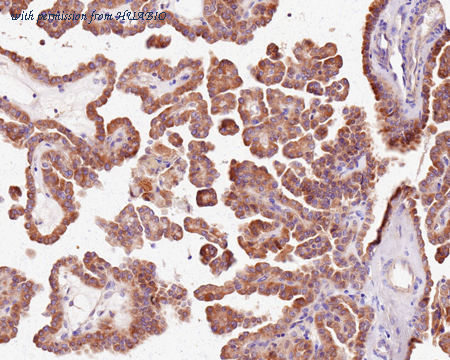 HUABIO HA750603 image 3