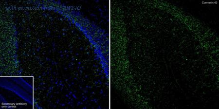 HUABIO HA750606 image 1