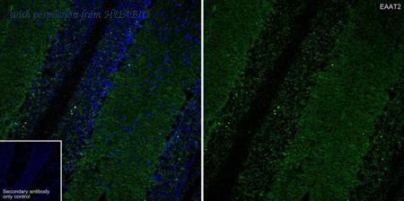 HUABIO HA750609 image 1