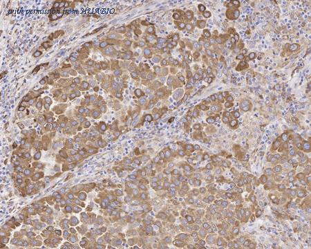 HUABIO HA750637 image 1