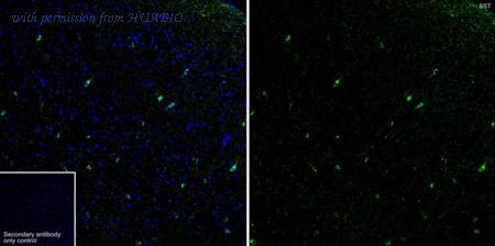 HUABIO HA750648 image 1