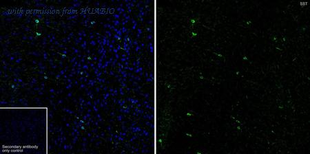 HUABIO HA750648 image 3