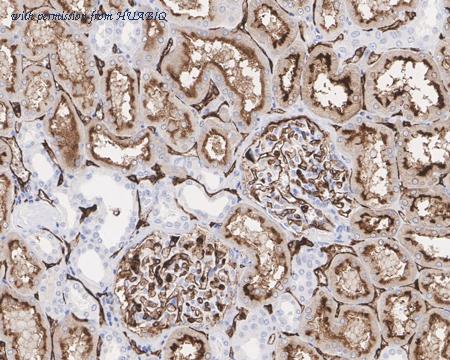 HUABIO HA750658 image 3