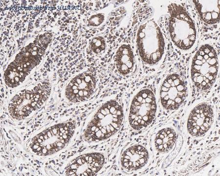 HUABIO HA750663 image 2