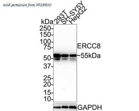 HUABIO HA750666 image 1