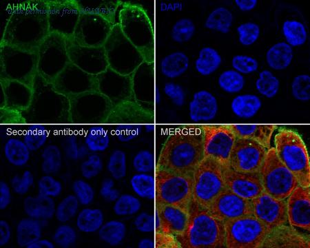 HUABIO HA750686 image 1