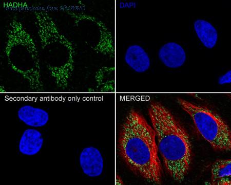 HUABIO HA750706 image 2