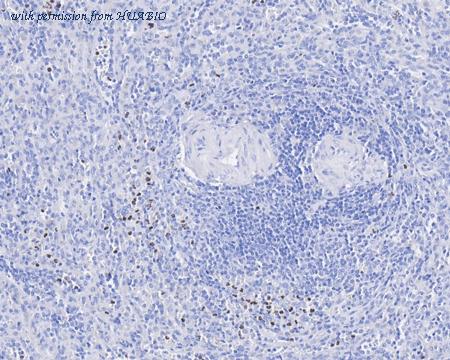 HUABIO HA750711 image 2