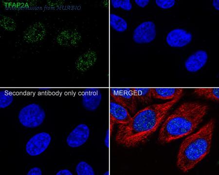 HUABIO HA750775 image 2