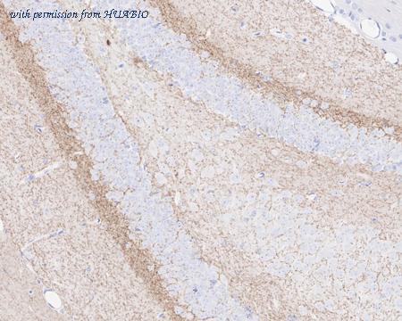 HUABIO HA750808 image 3