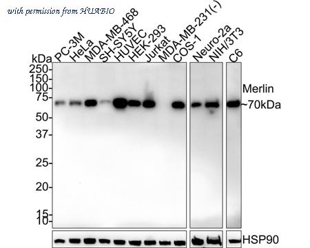 HUABIO HA750815 image 1