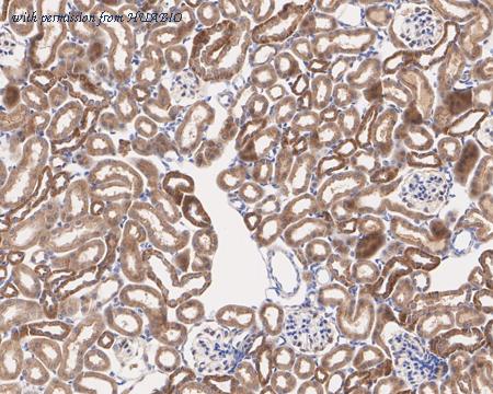 HUABIO HA750822 image 2