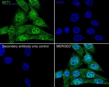 HUABIO HA750845 image 3