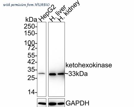HUABIO HA750860 image 1