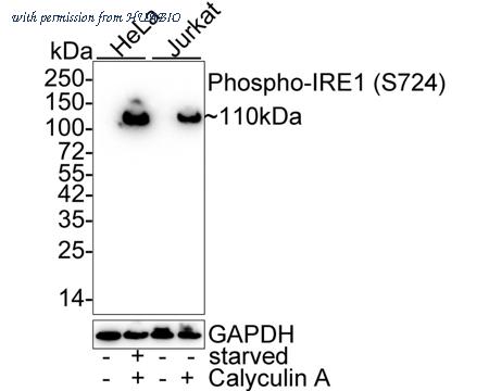 HUABIO HA750869 image 1
