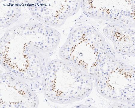 HUABIO HA750870 image 2