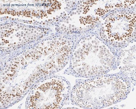 HUABIO HA750870 image 3