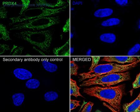 HUABIO HA750874 image 3