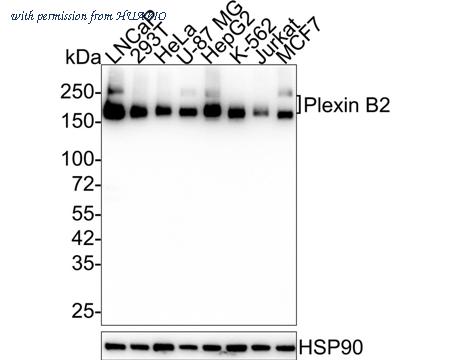HUABIO HA750882 image 1