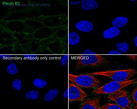 HUABIO HA750882 image 2