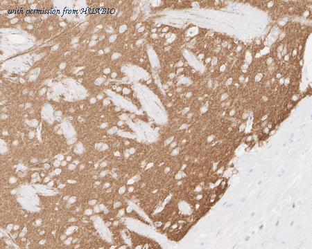 HUABIO HA750895 image 2