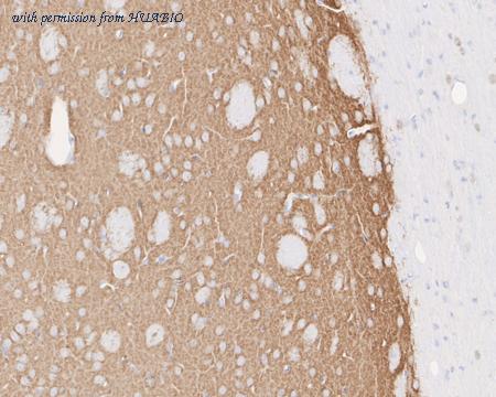 HUABIO HA750895 image 3